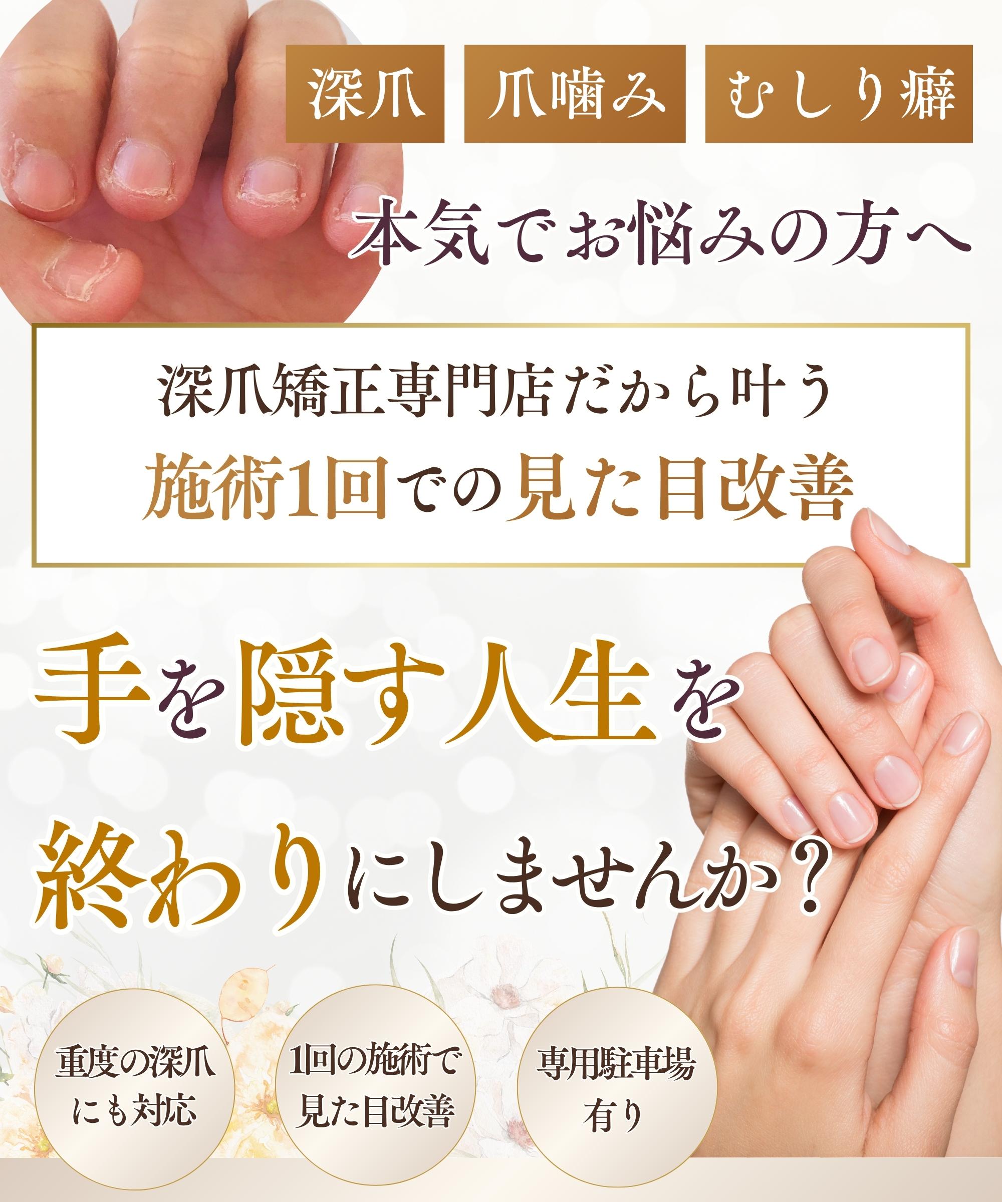 埼玉・さいたま市｜深爪矯正専門店 ネイルサロン トイロ