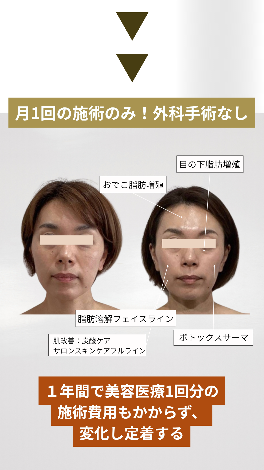 変化が定着