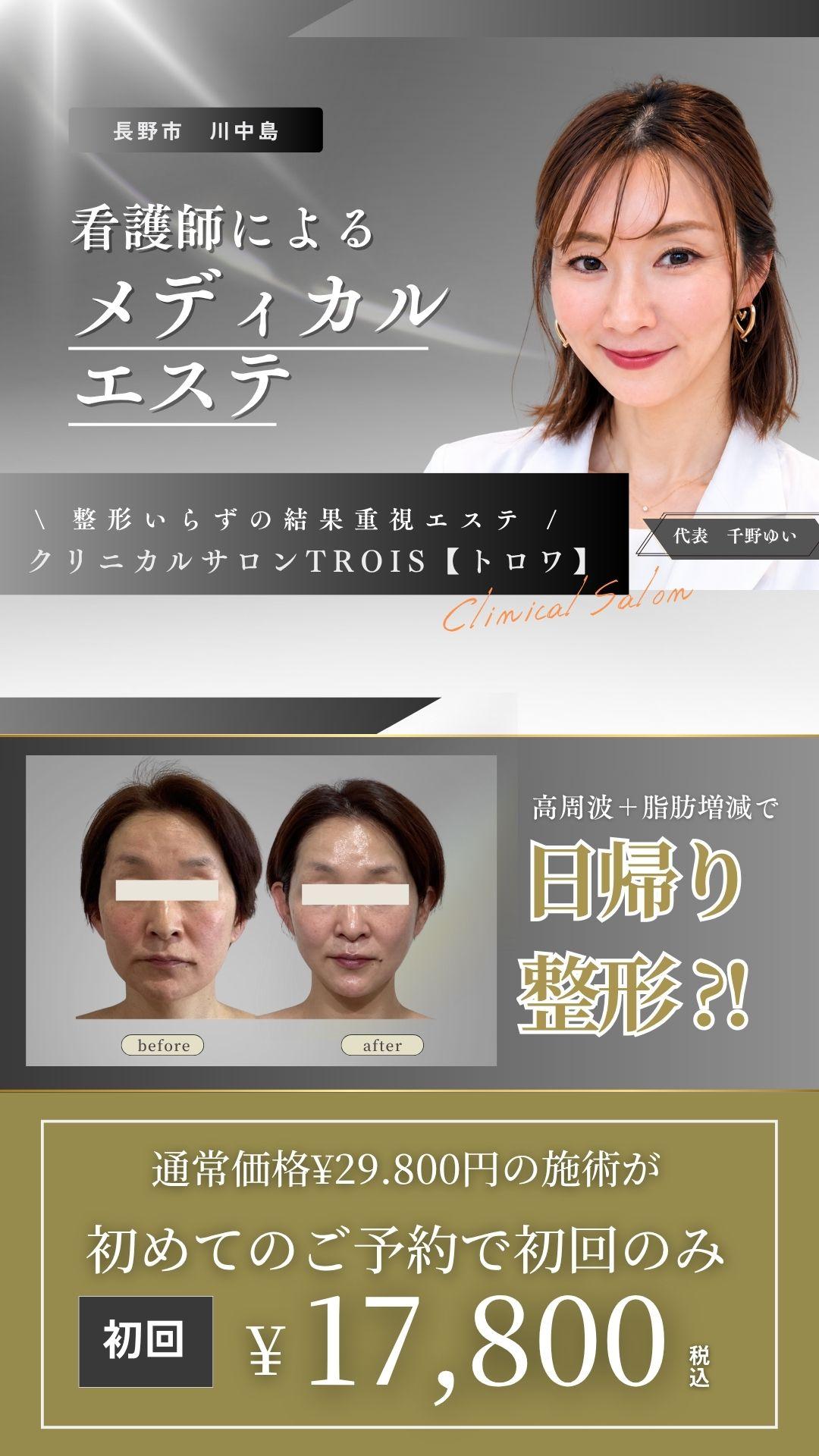 長野市エステ　看護師によるメディカルエステ　クリニカルサロン・トロワ　整形いらずの結果重視　長野市エステ