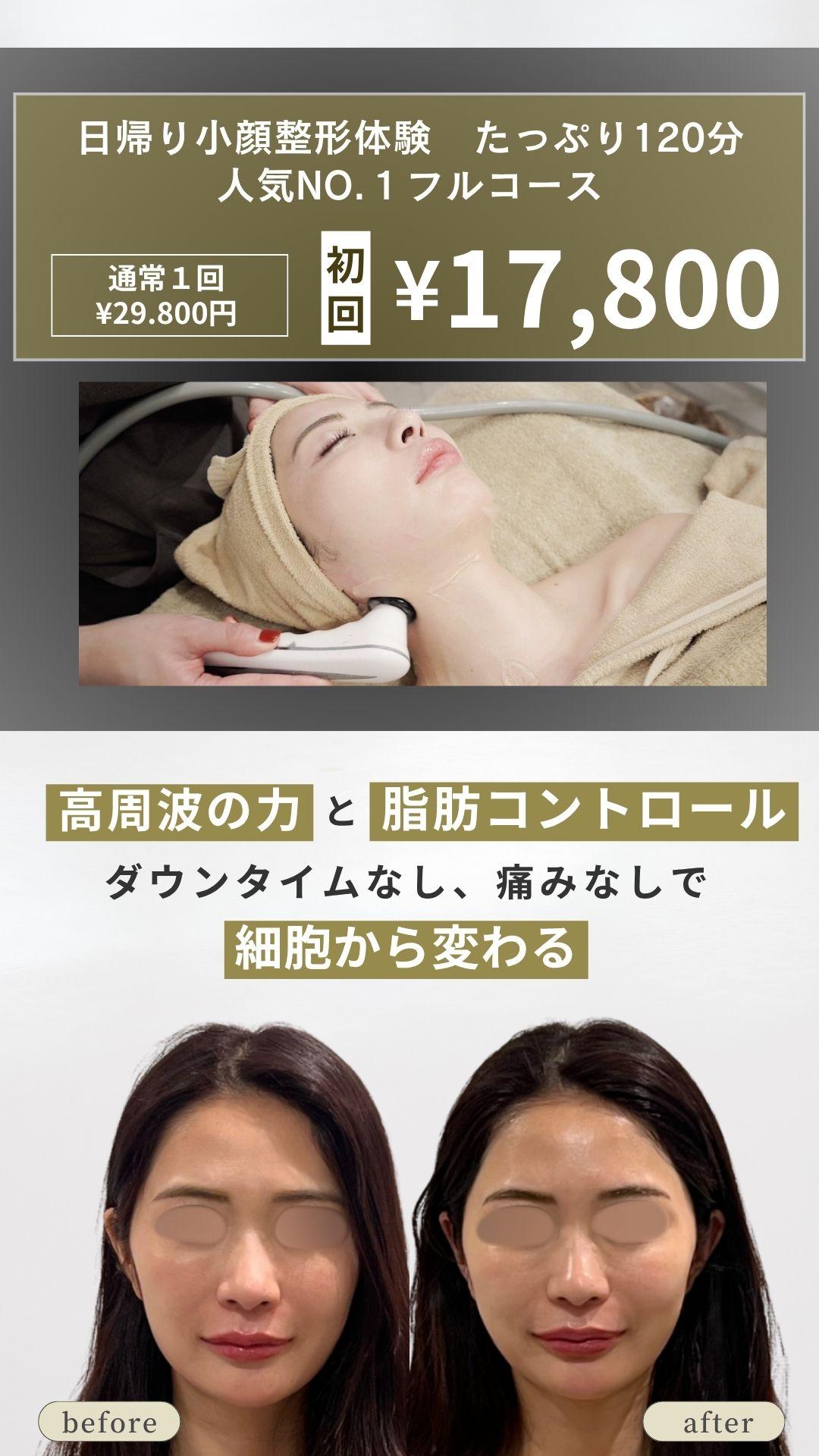 人気NO.1フルコース　17.800円　高周波と脂肪コントロール