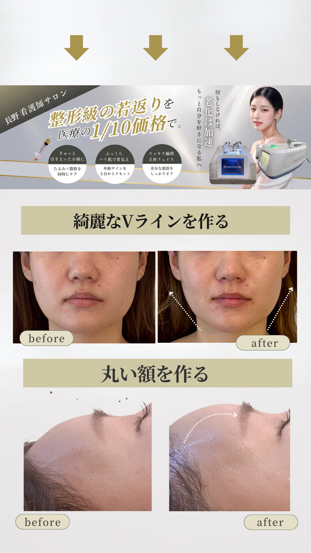 きれいなVライン　丸い額