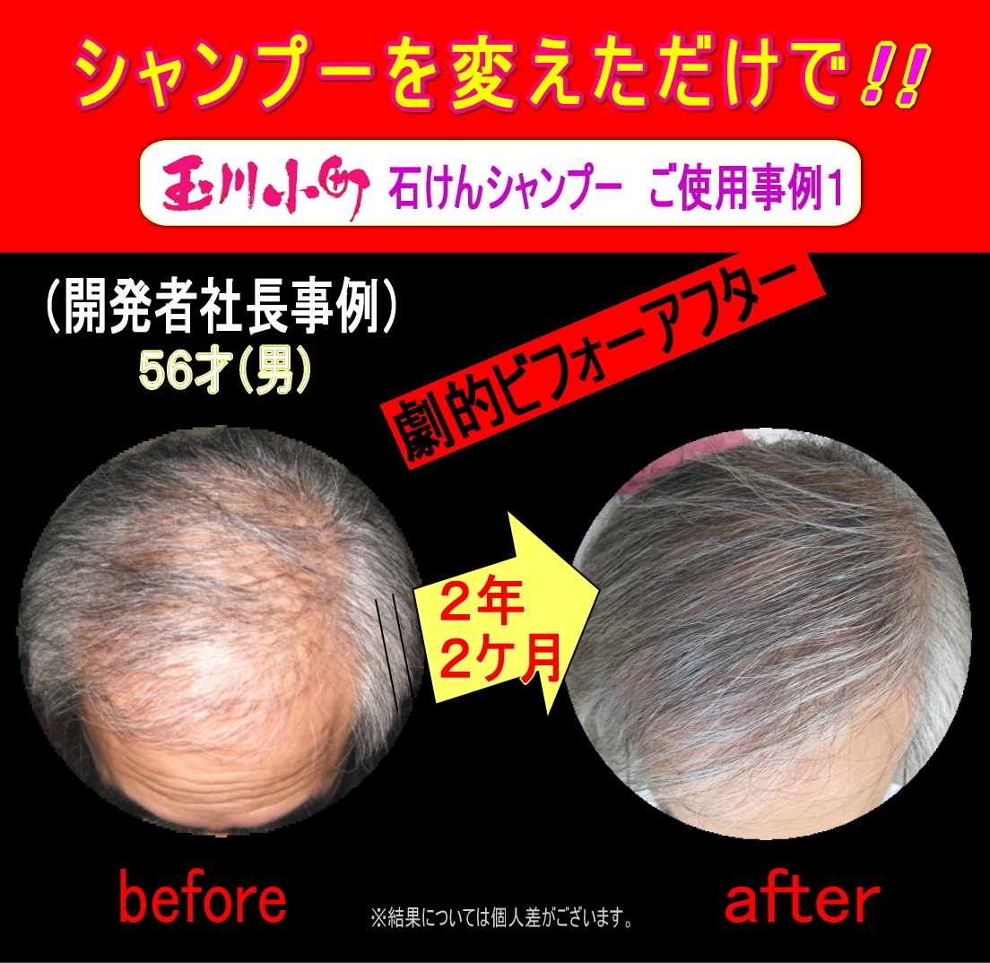 シャンプーを変える前と後の社長の髪の毛が戻った比較写真です。