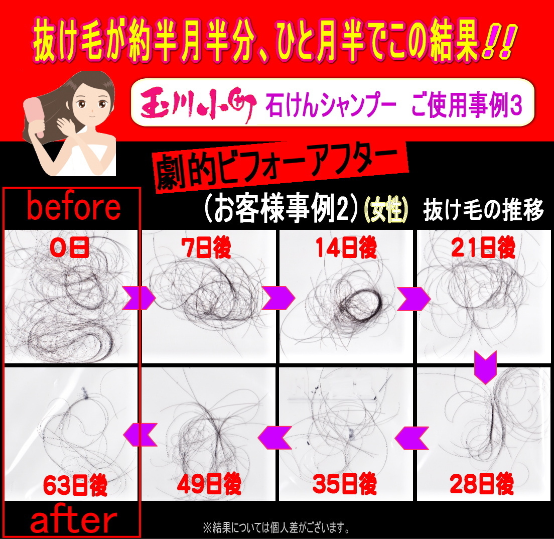 アレルギー体質、敏感肌のお客様がシャンプーの抜け毛の状態をサンプリングしてくださいました。1週間ごとの抜け毛の推移の写真です。明らかに抜け毛が減っています。