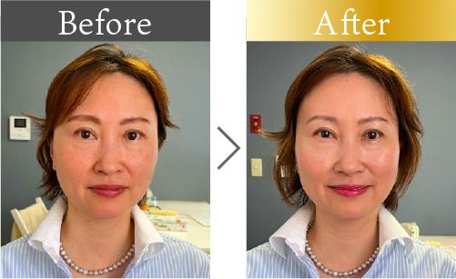 40代女性のビフォーアフター。眉を整えて垢抜けた印象へ。