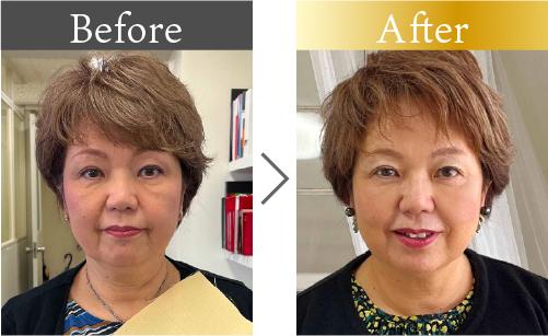 60代女性のビフォーアフター。メイクを変えて若々しい印象へ。