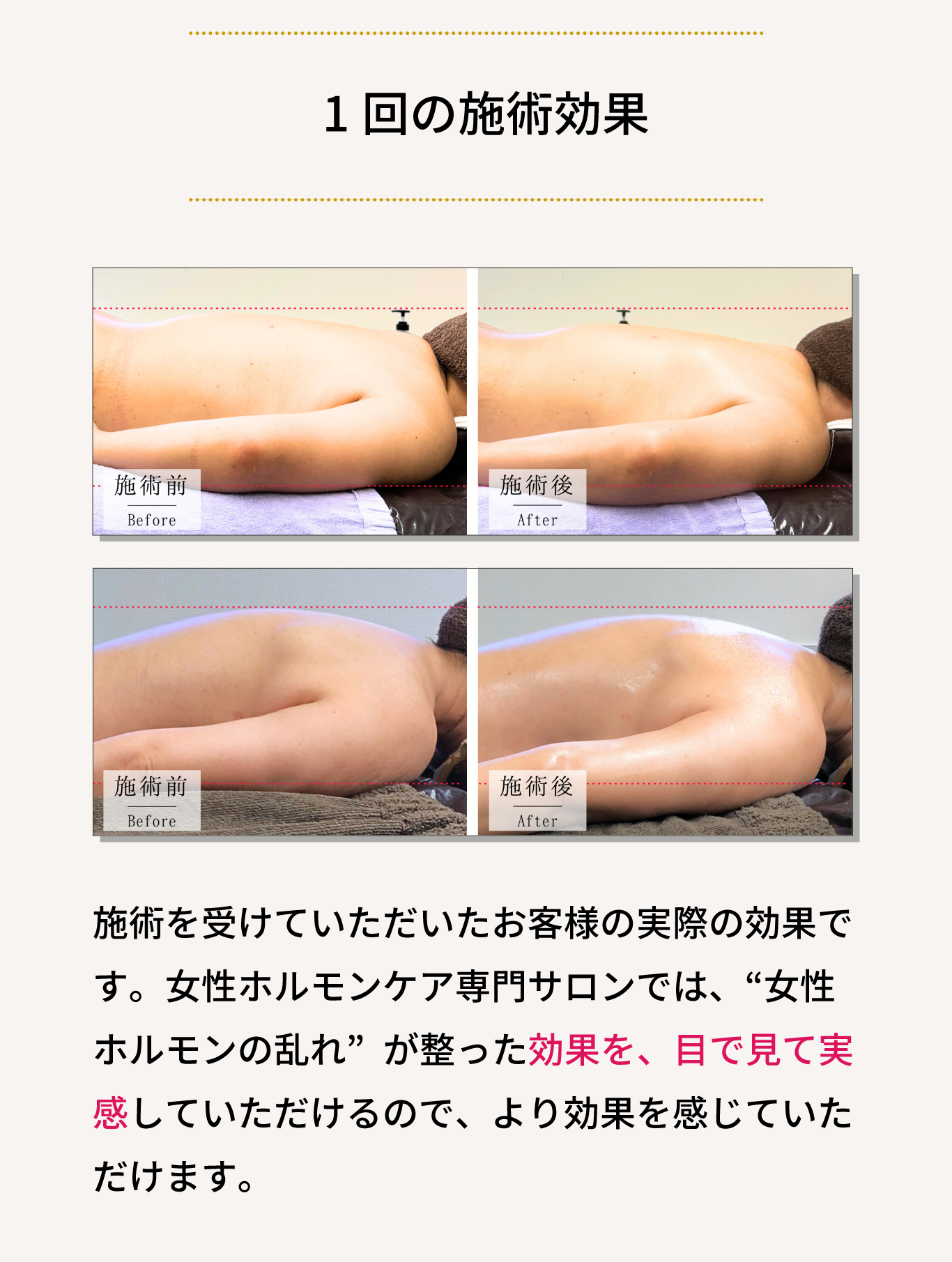 1回の施術効果！施術を受けていただいたお客様の実際の効果で す。女性ホルモンケア専門サロンでは、“女性 ホルモンの乱れ”が整った効果を、目で見て実 感していただけるので、より効果を感じていた だけます。