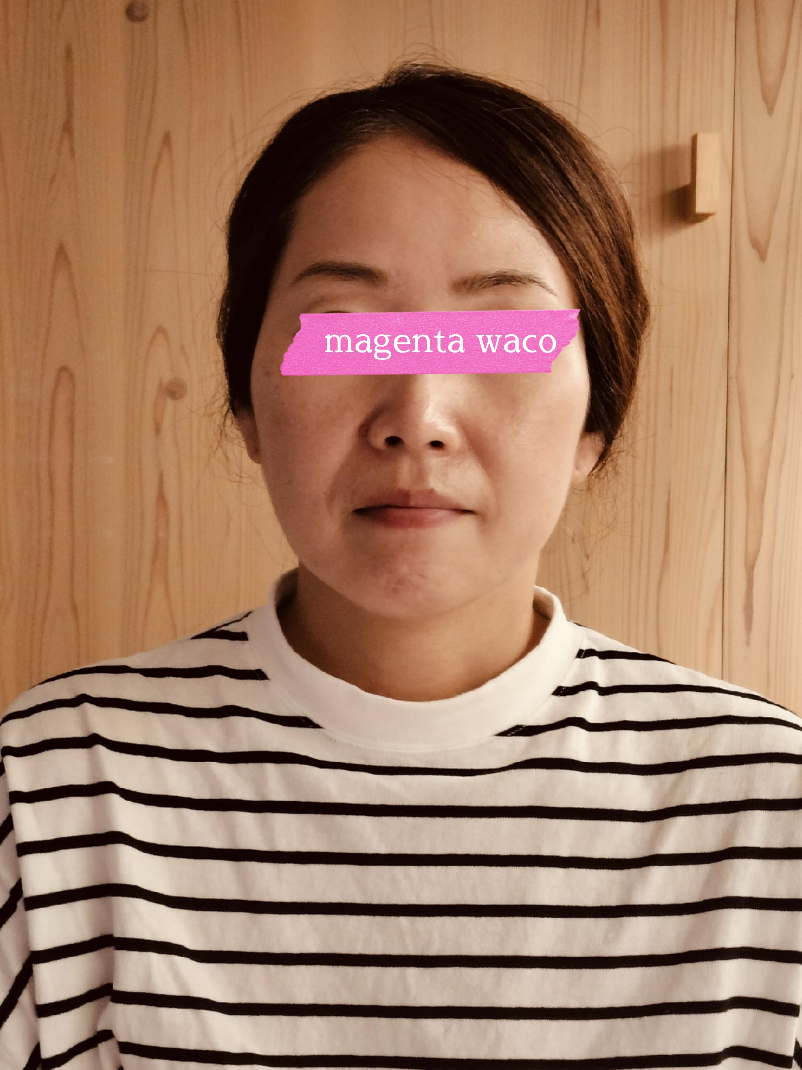 Magenta wacoマジェンタ･ワコ　顔コリほぐし1ビフォー