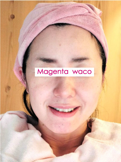 Magenta wacoマジェンタ･ワコ　顔コリほぐし２ビフォー