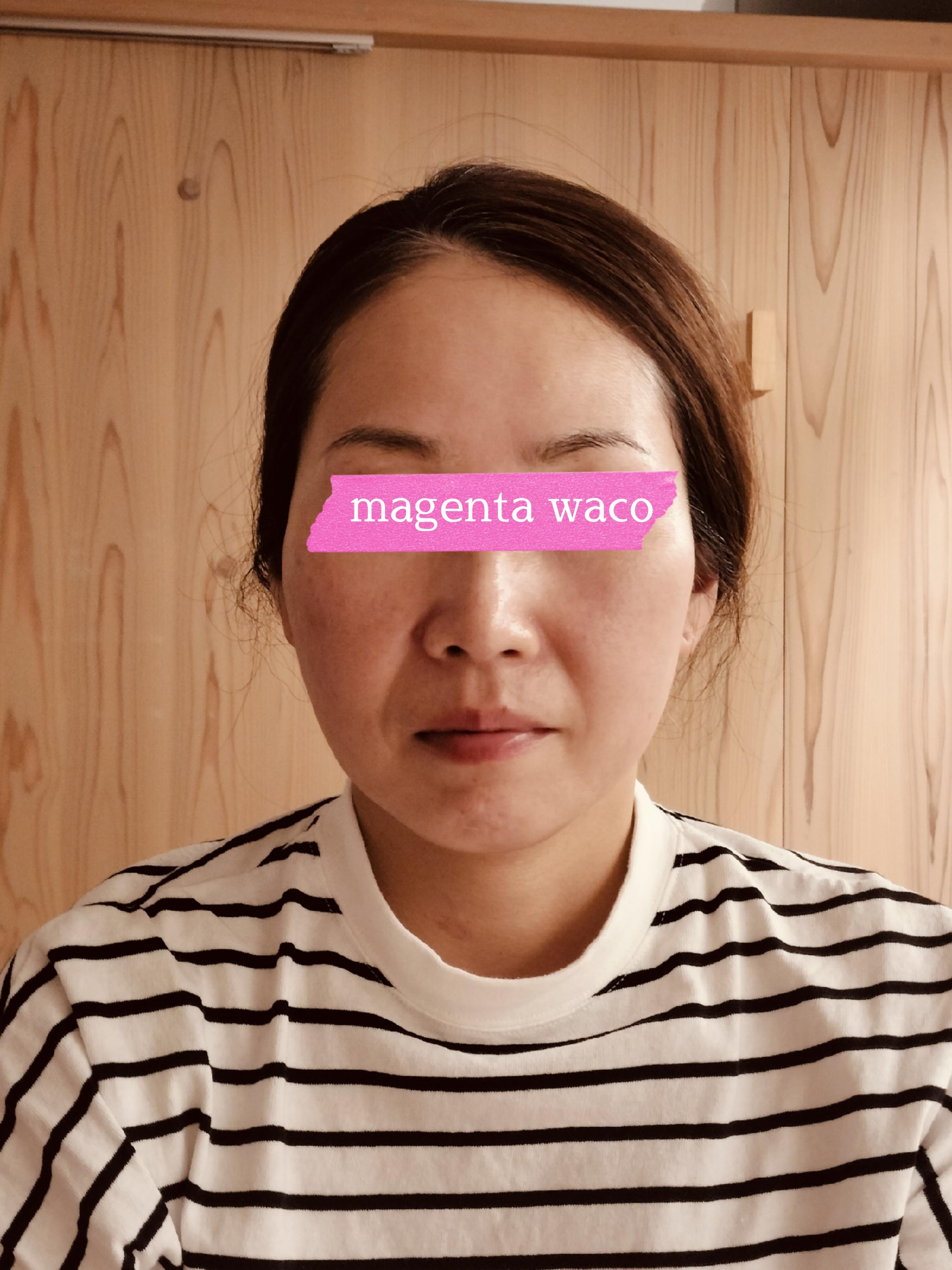 Magenta wacoマジェンタ･ワコ　顔コリほぐし1アフター
