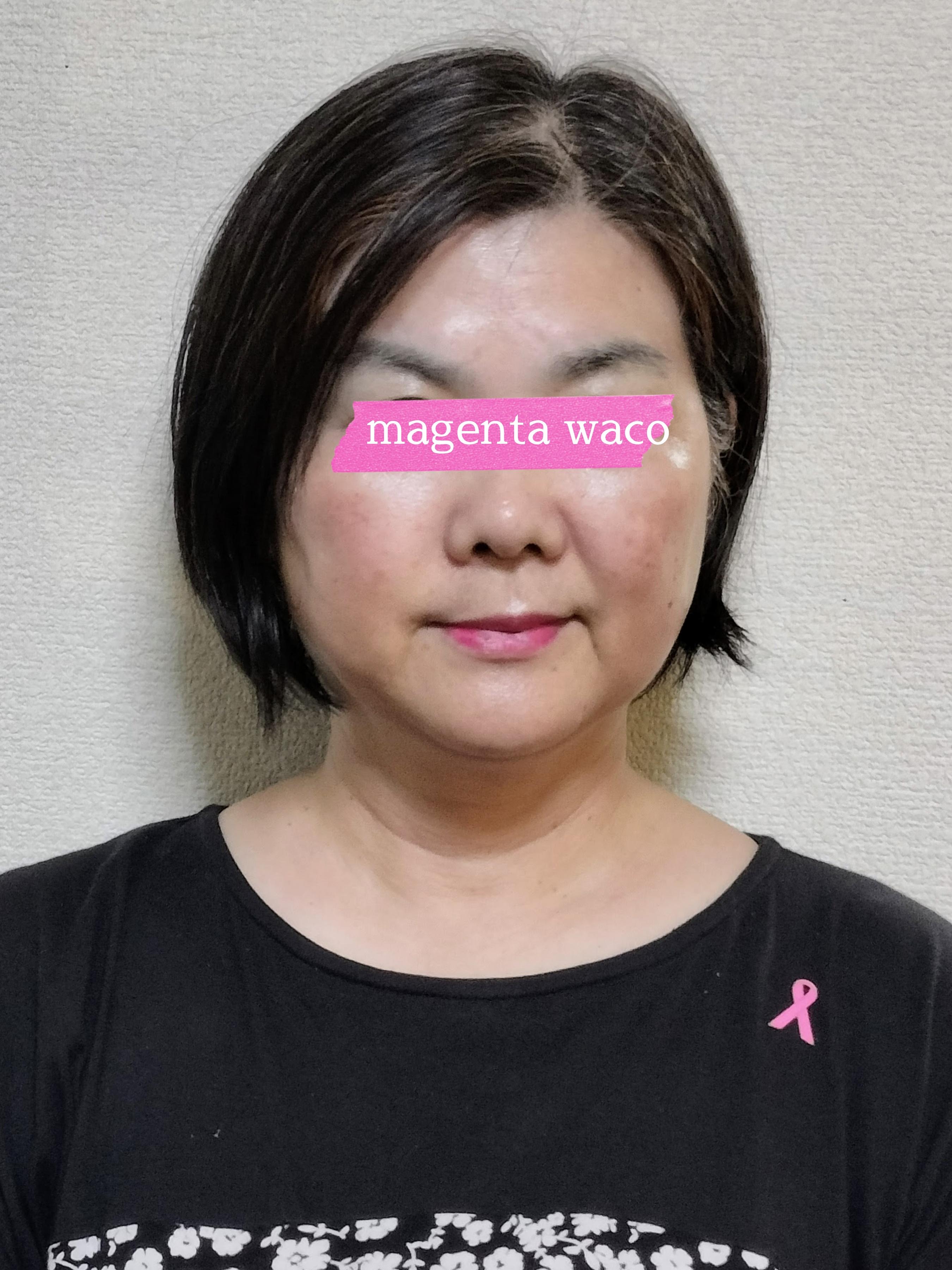 Magenta wacoマジェンタ･ワコ　顔コリほぐし1アフター